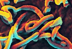 Ebola_Virus_(5)